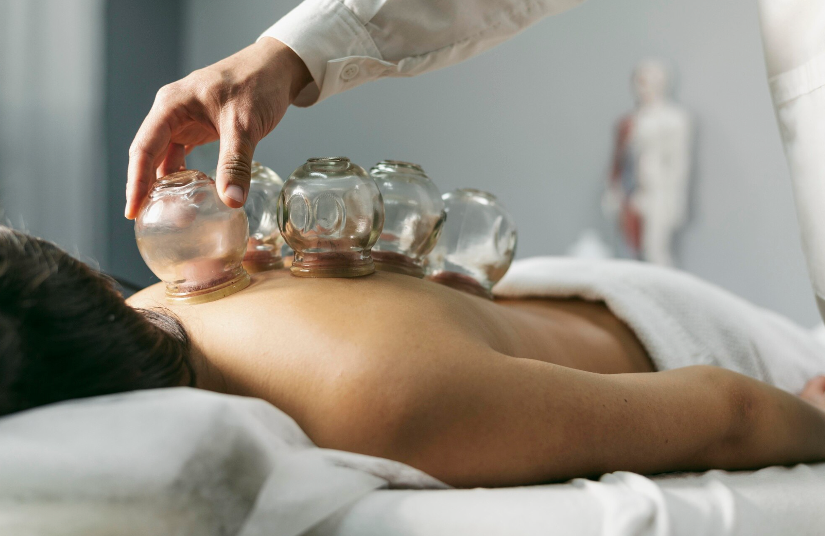 Cupping Therapy